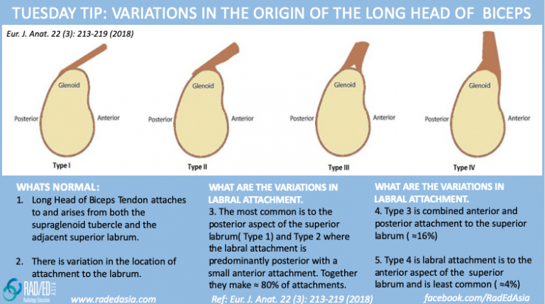 mri biceps shoulder attachment anatomy slap radiology education asia
