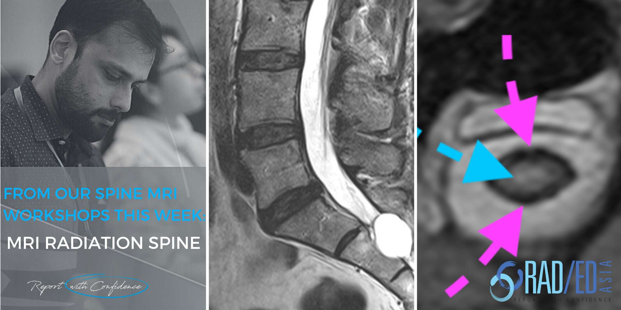 mri radiation spine spine mri online radiology courses