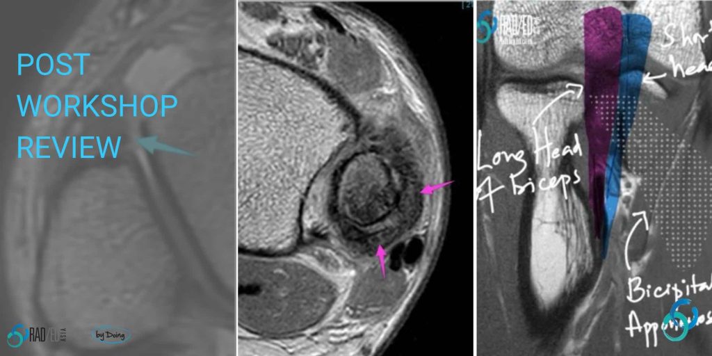 small joints mri radiology education asia