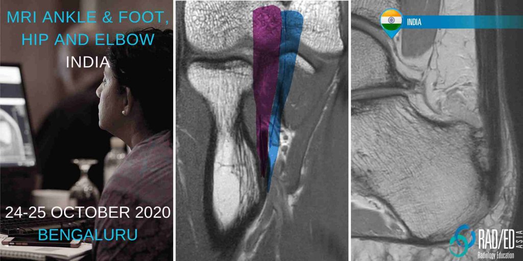 BLHAE20Oct mri msk learn radiology online mri ankle radedasia