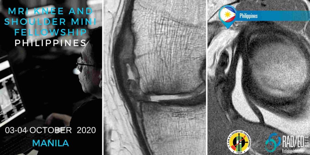 MNKS20Oct manila learn radiology online mri msk knee shoulder radedasia