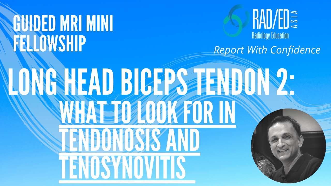 mri biceps tendon tendonosis tear rupture tenosynovitis radiology education asia