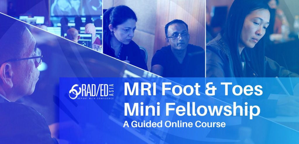 radiology-courses-MSK-MRI-Foot-Toes-guided-learning-radedasia