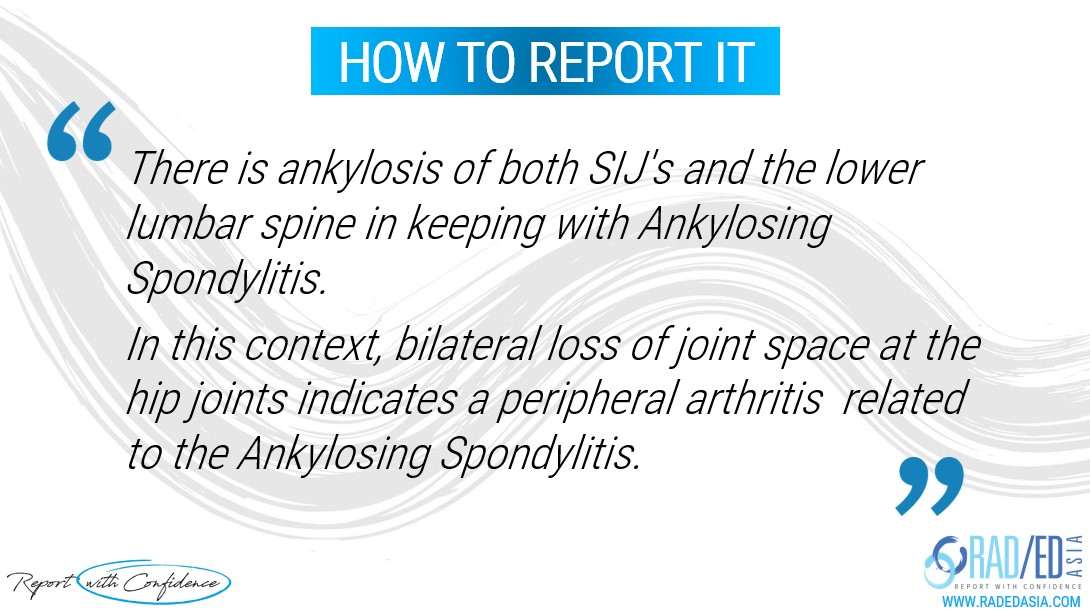 ankylosing spondylitis hip involvement imaging xray report radedasia