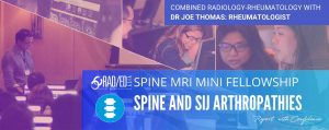 learn spine mri radiology spondyloarthropathy ankylosing spondylitis radedasia