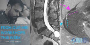 spine mri msk online radiology courses radedasia