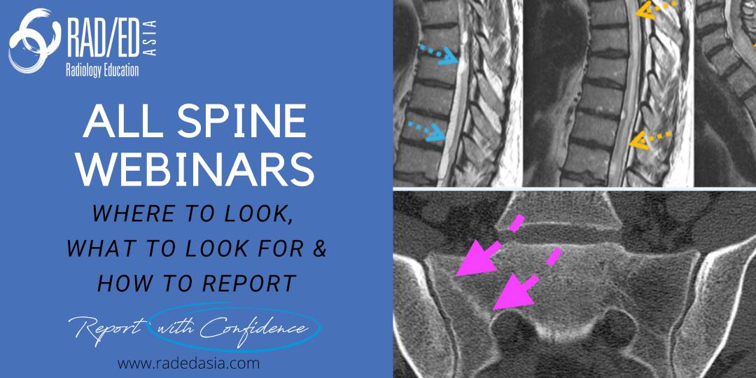 Spine-imaging-webinar-spine-mri-ct-webinar-online