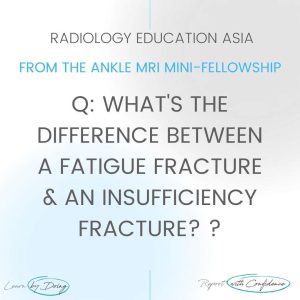 stress fracture fatigue insufficiency fracture radiology mri radedasia