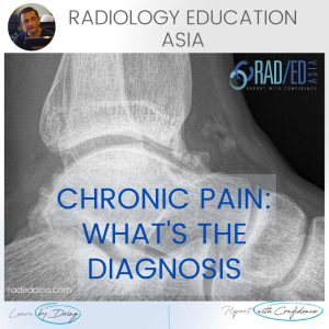 ankle impingement radiology anterior xray mri radedasia