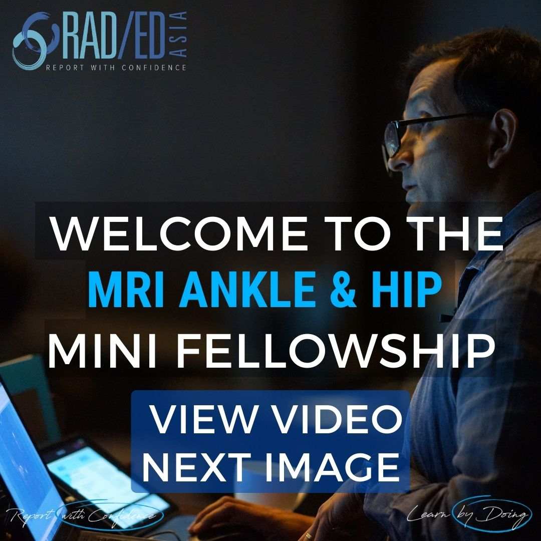 msk radiology conference course mri ankle hip radiology radedasia