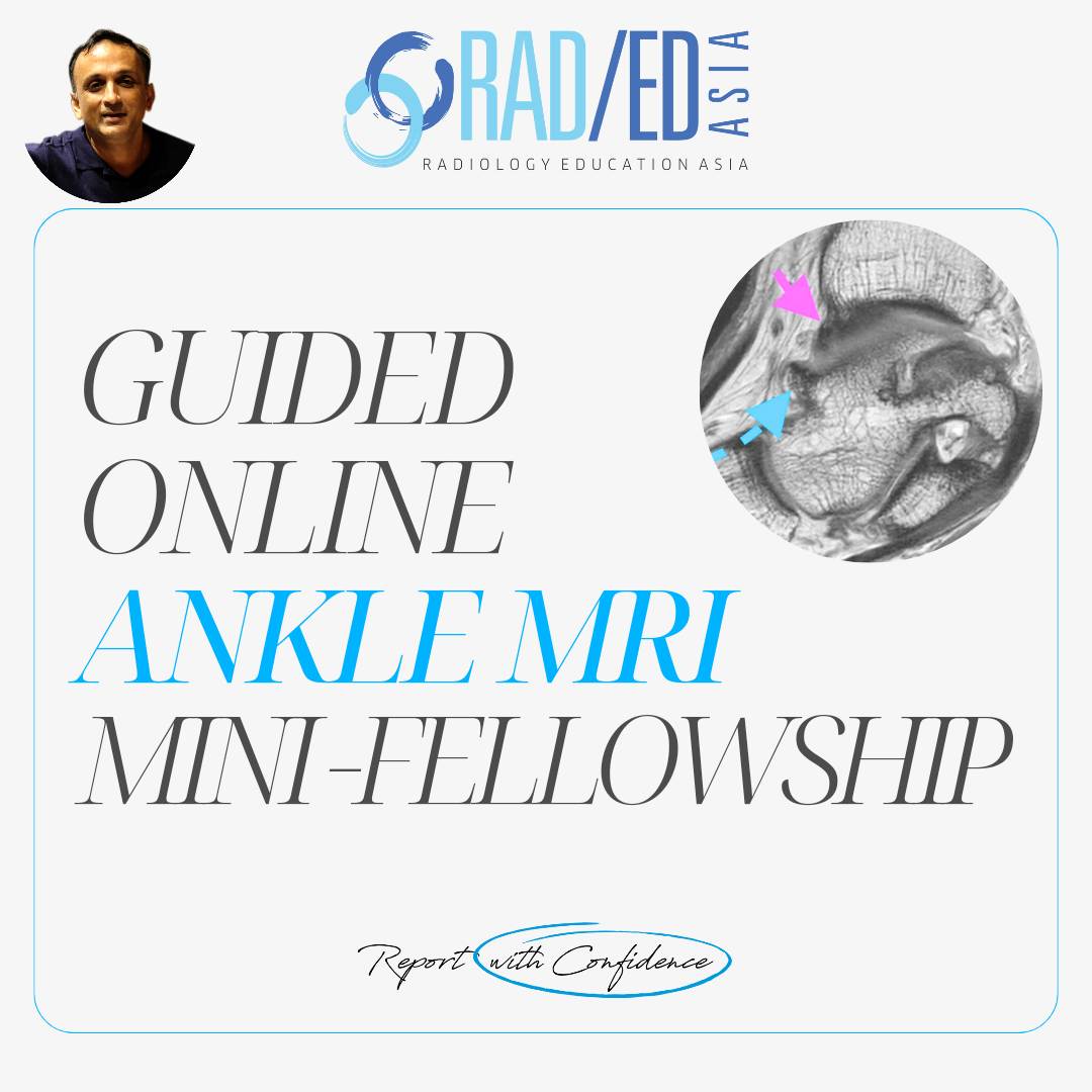 ankle-mri-msk-online-musculoskeletal-foot-course-learn-radiology-imaging-radedasia-rea