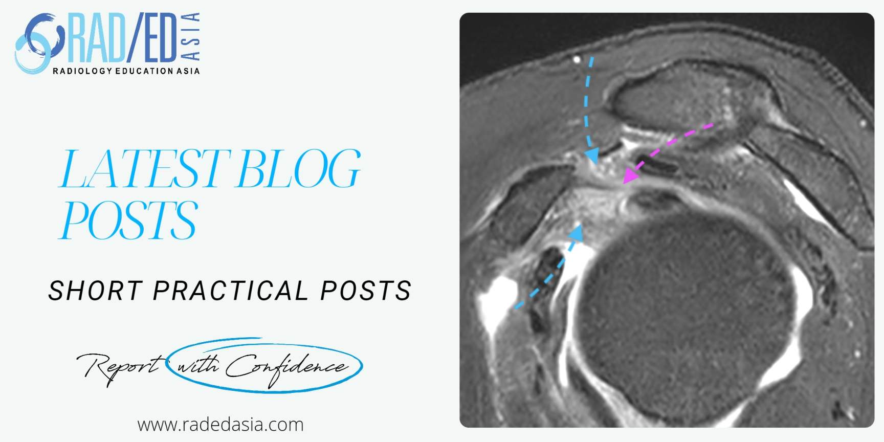 blog-header-mri-ct-ultrasound-scans-imaging-radiology-radedasia