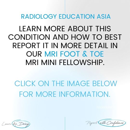 foot toe msk mri learn radiology online course radedasia