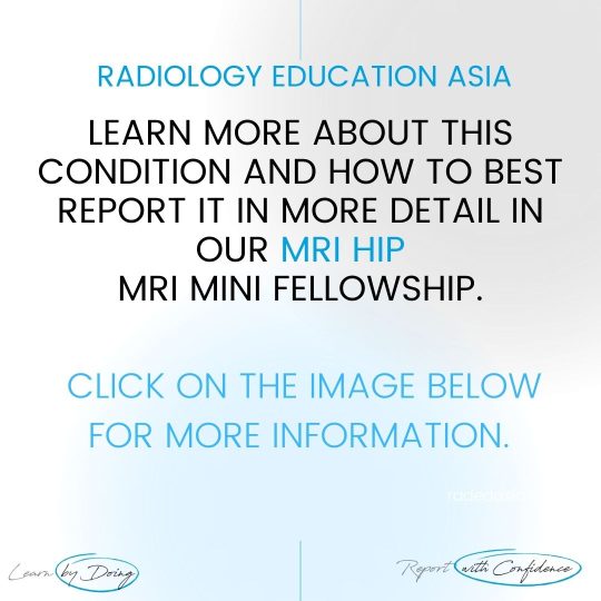 hip msk mri learn radiology online course radedasia