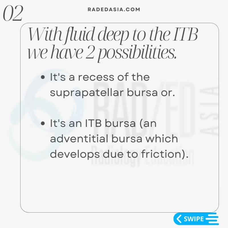 iliotibial itb band syndrome friction bursa radiology mri knee