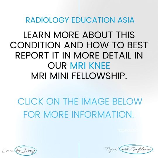 knee msk mri learn radiology online course radedasia