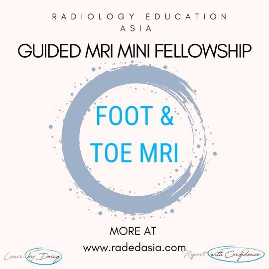 learn mri foot toe msk radiology online radedasia