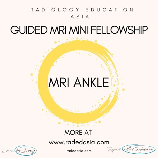 learn mri radiology ankle radedasia