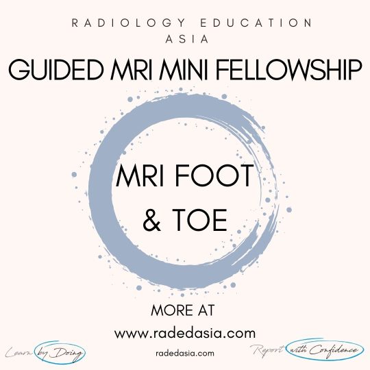 learn mri radiology foot toe radedasia