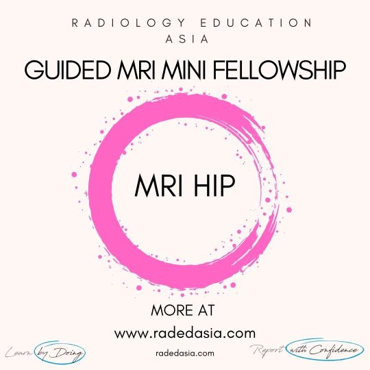 learn mri radiology hip radedasia