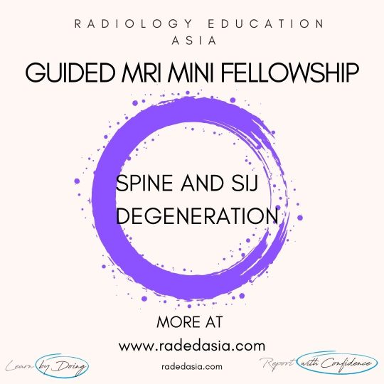 learn mri radiology spine degen radedasia