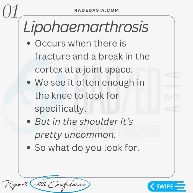 lipohemarthrosis radiology xray shoulder radedasia