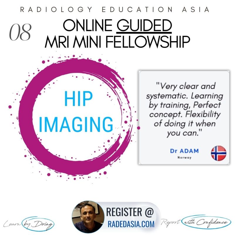 mri hip learn musculoskeletal msk mri radedasia