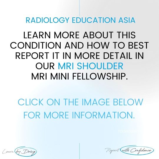 shoulder msk mri learn radiology online course radedasia