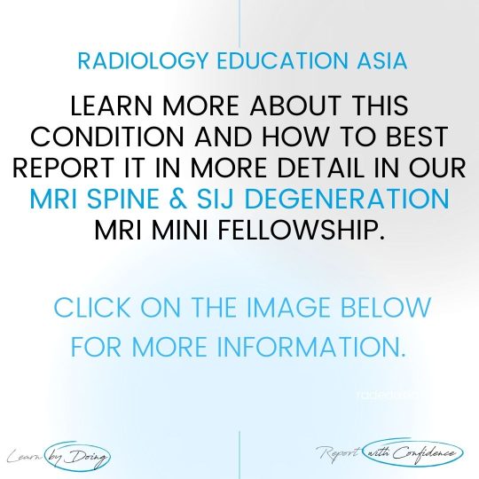 spine sij degen mri learn radiology online course radedasia