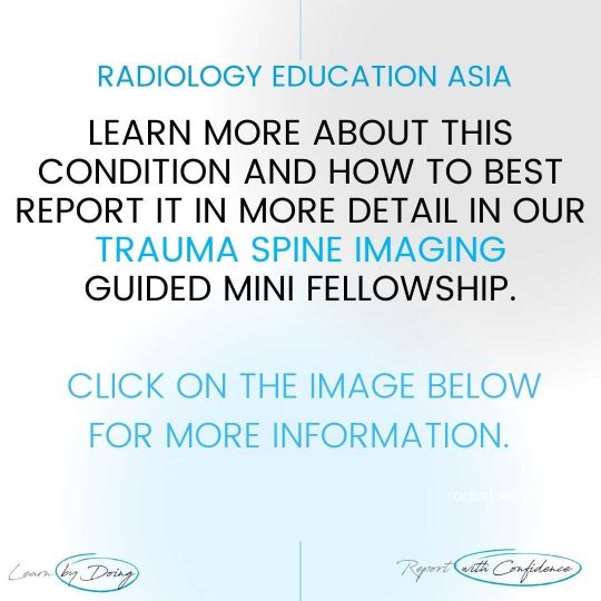 spine trauma imaging learn mri radiology online course radedasia